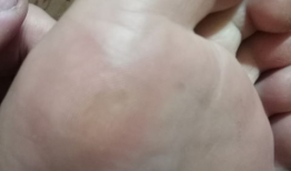 去除鸡眼视频,跟随视频教程学除法